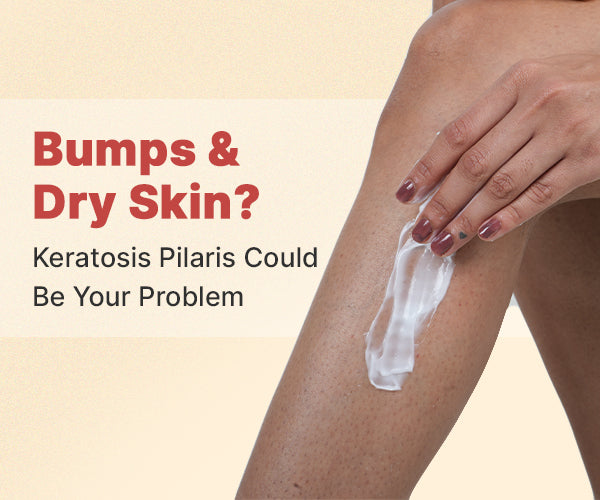 Bumpy skin on arms and legs? - Keratosis Pilaris